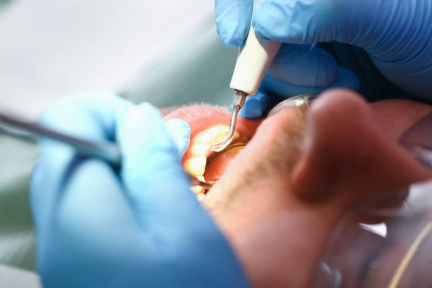 Best Emergency Treatment for Toothache in Middletown, CA