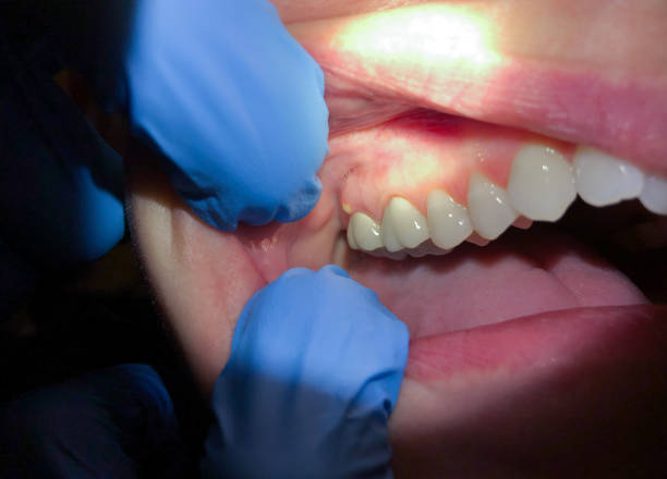 Best Pediatric Emergency Dentist in Middletown, CA