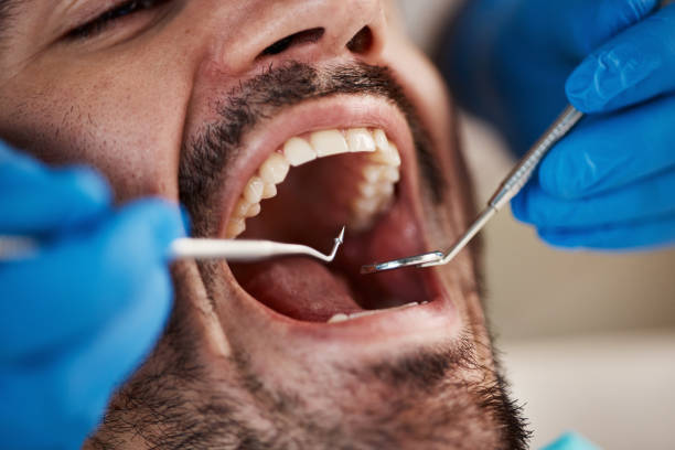 Best Emergency Dental Surgery in Middletown, CA